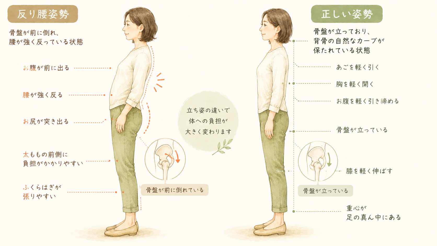 反り腰と正しい姿勢の比較図